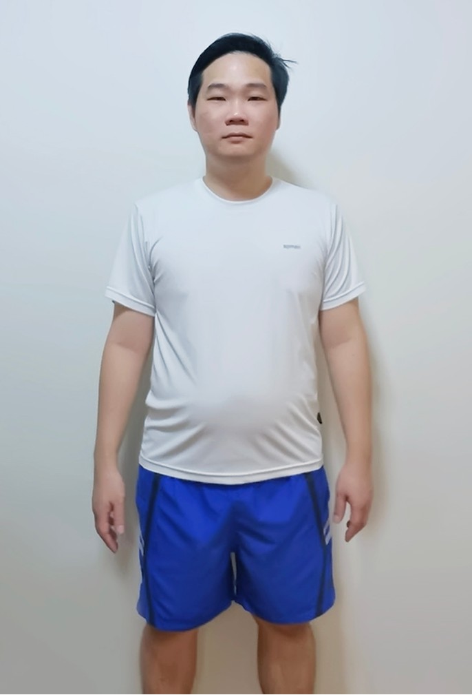 Before Losing Weight
