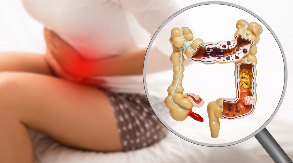 Inflammation and weight loss
