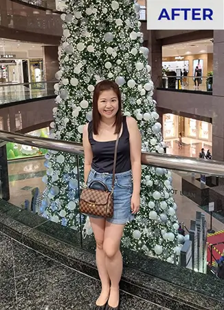 before weight loss picture