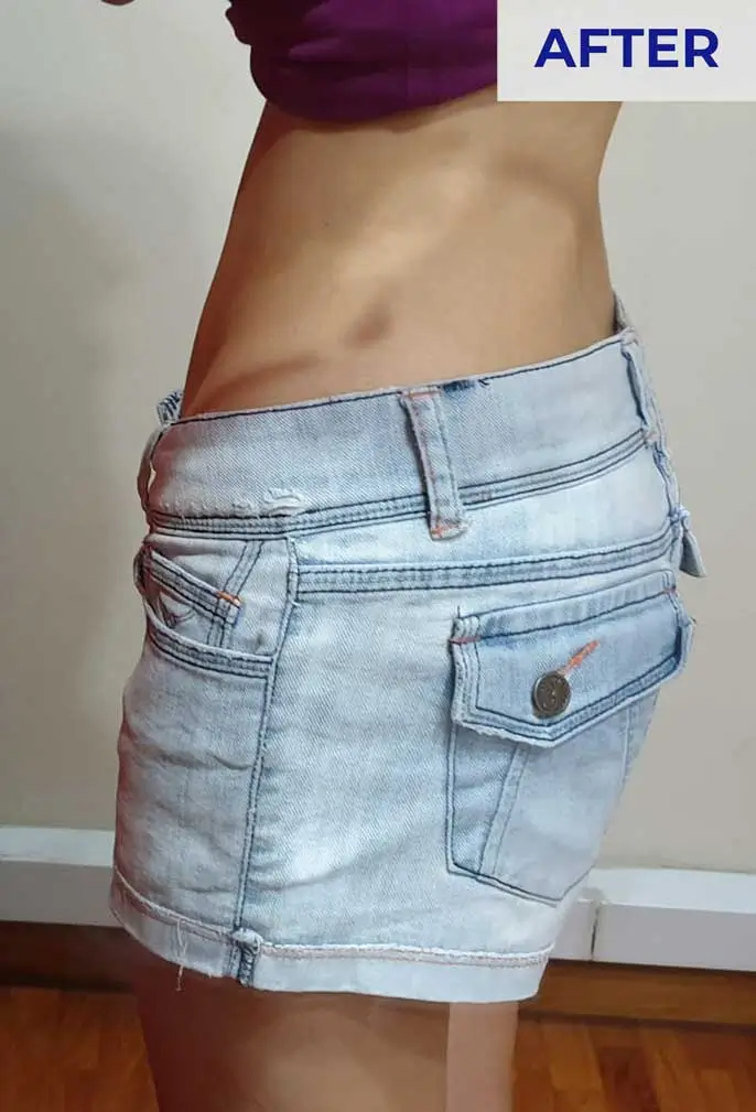 Before Weight Loss Program Singapore