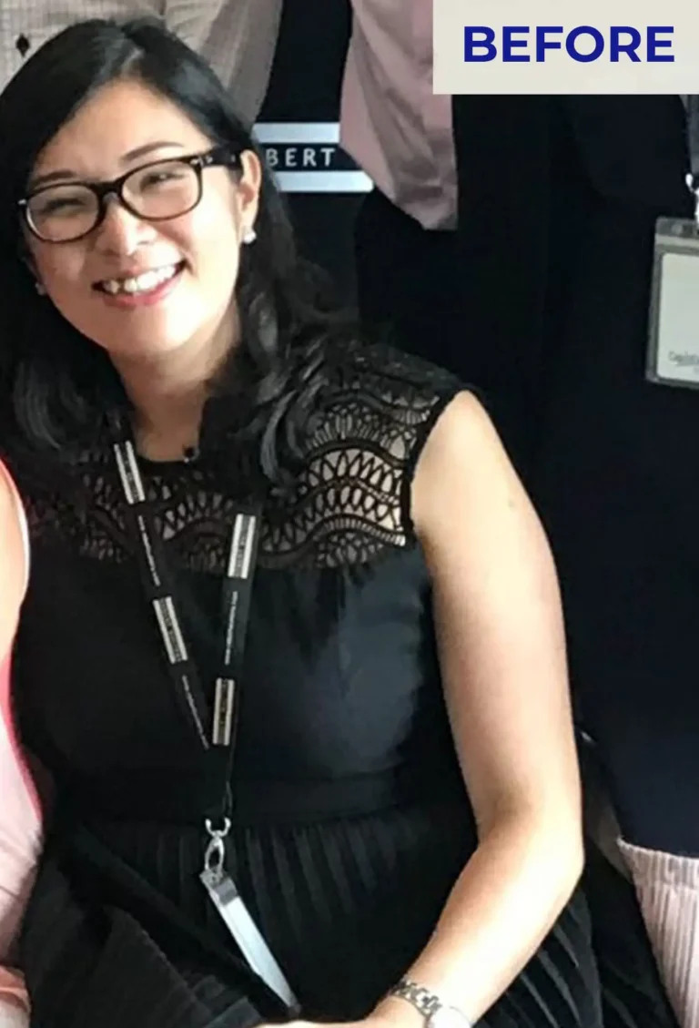 Before Healthy Weight Loss Program