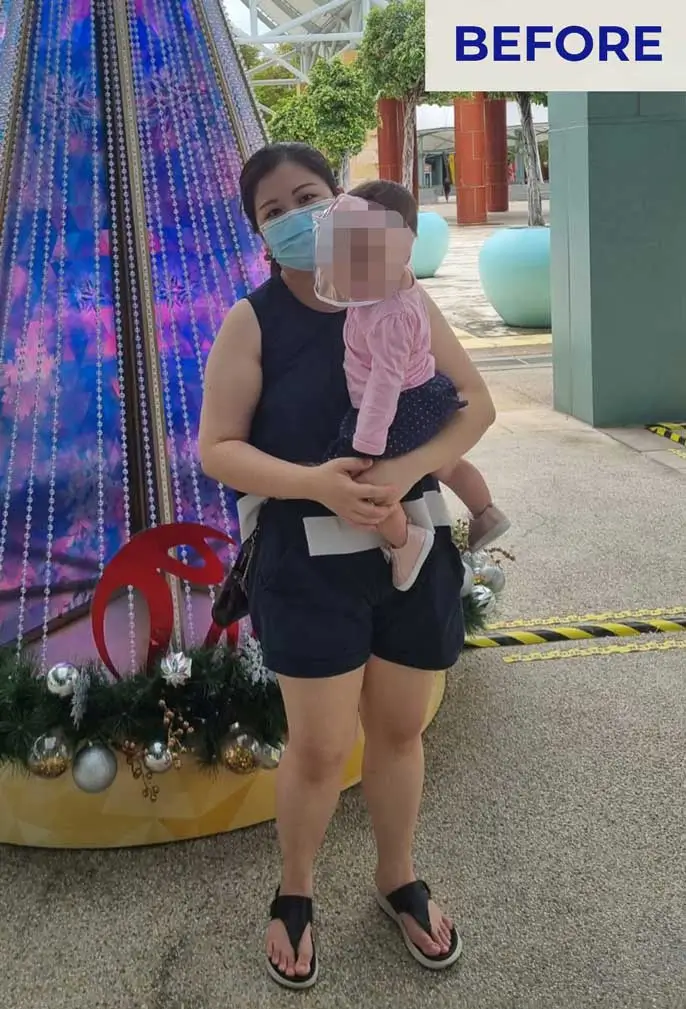 before weight loss picture